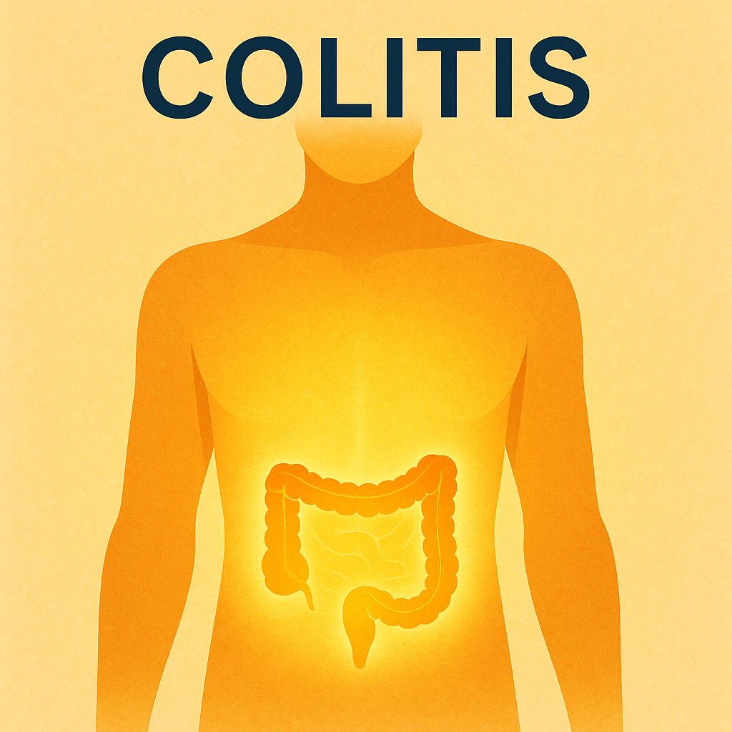 colitis